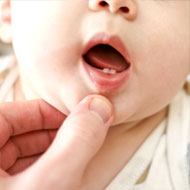 Tooth Problems In Toddlers